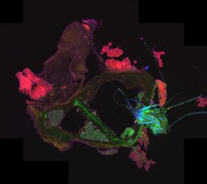 Picture of fluorescent imaging