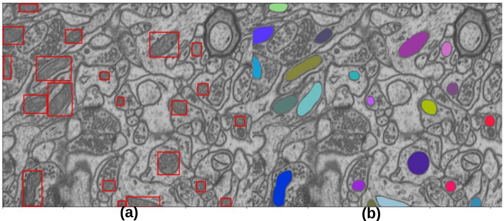 Figure 2: The mitochondria region of interest is detected and then segmented by utilizing Mask R-CNN two-stage object detection technique.