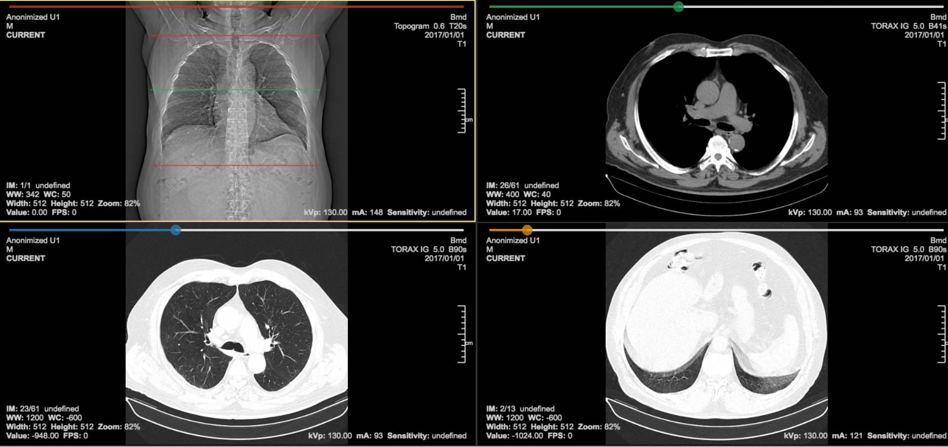 Are you familiar with all of PACScenter's MPR tools? - BMD Software