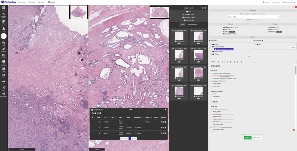 Screenshot of the PathoBox digital pathology platform showing a high-resolution whole-slide image viewer, annotation tools, measurement data, and a structured pathology report template on the right side of the interface