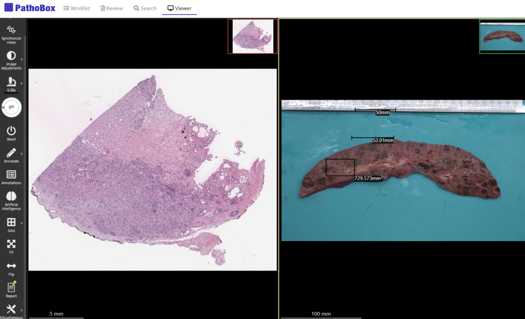 Macroscopic image support in PathoBox