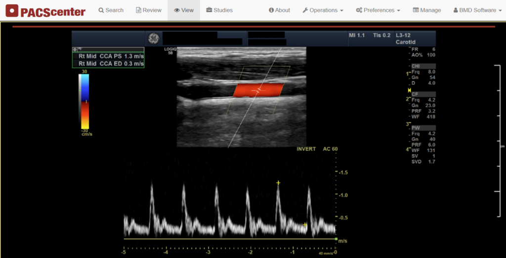 Ultrasound scan showing patient information removed from the image header through automatic DICOM de-identification